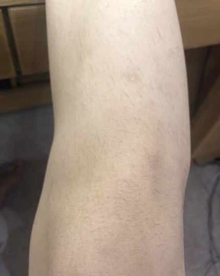 脱毛クリーム MOOMO/自然化粧品研究所/除毛クリームを使ったクチコミ(2枚目)