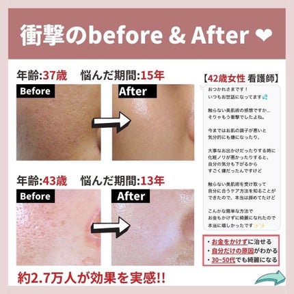 あなたの肌に合ったスキンケア💐コーくん先生 on LIPS 「【本当にやめて!】こんな人は毛穴の開き一生消えません。.
.
..」(7枚目)