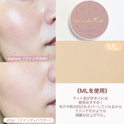 マシュマロフィニッシュパウダー/キャンメイク/プレストパウダーを使ったクチコミ(5枚目)