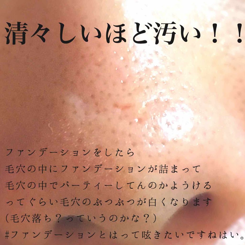 重曹泡洗顔/毛穴撫子/泡洗顔を使ったクチコミ（2枚目）