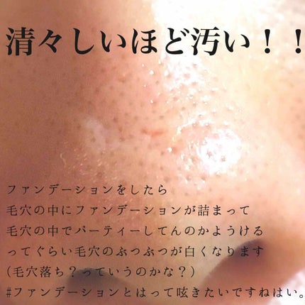 重曹泡洗顔/毛穴撫子/泡洗顔を使ったクチコミ(2枚目)