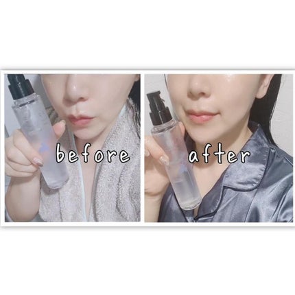 あたりちゃん♥️フォロバ&イイネ返し on LIPS 「年々肌悩みは増えてくる😅肌のくすみ、ハリやツヤ感がなくなったり..」(7枚目)