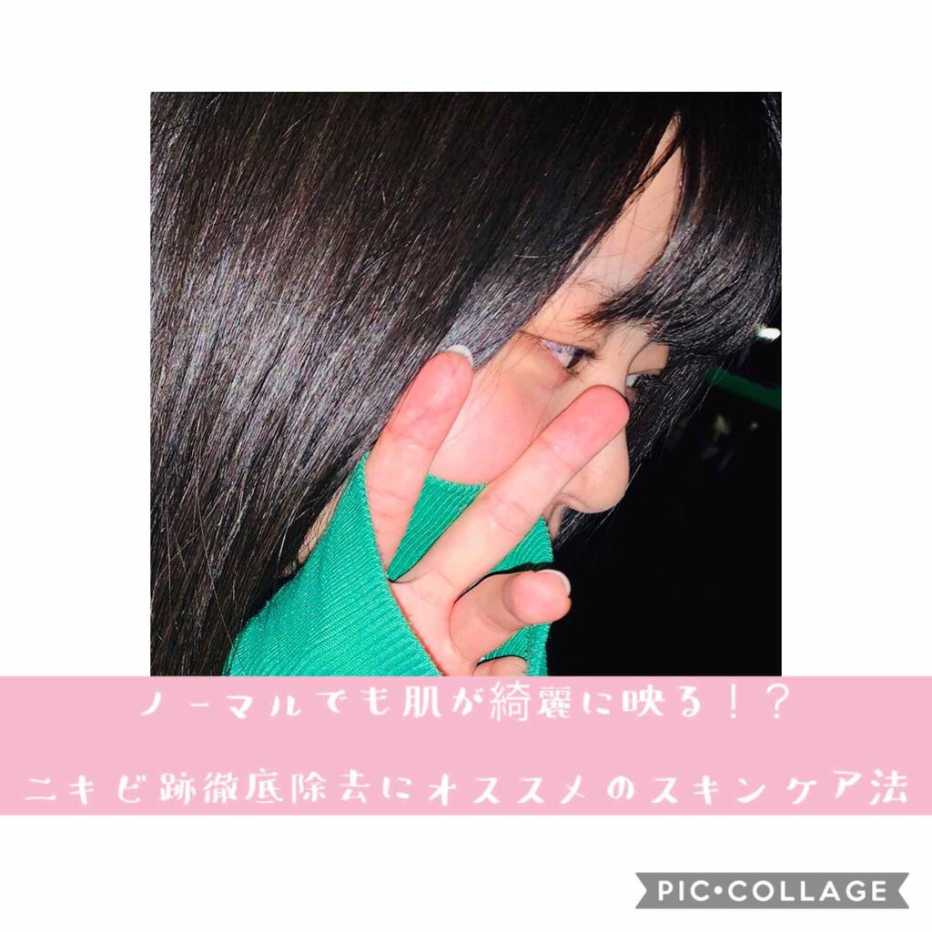 明色美顔水 薬用化粧水/美顔/化粧水を使ったクチコミ(1枚目)