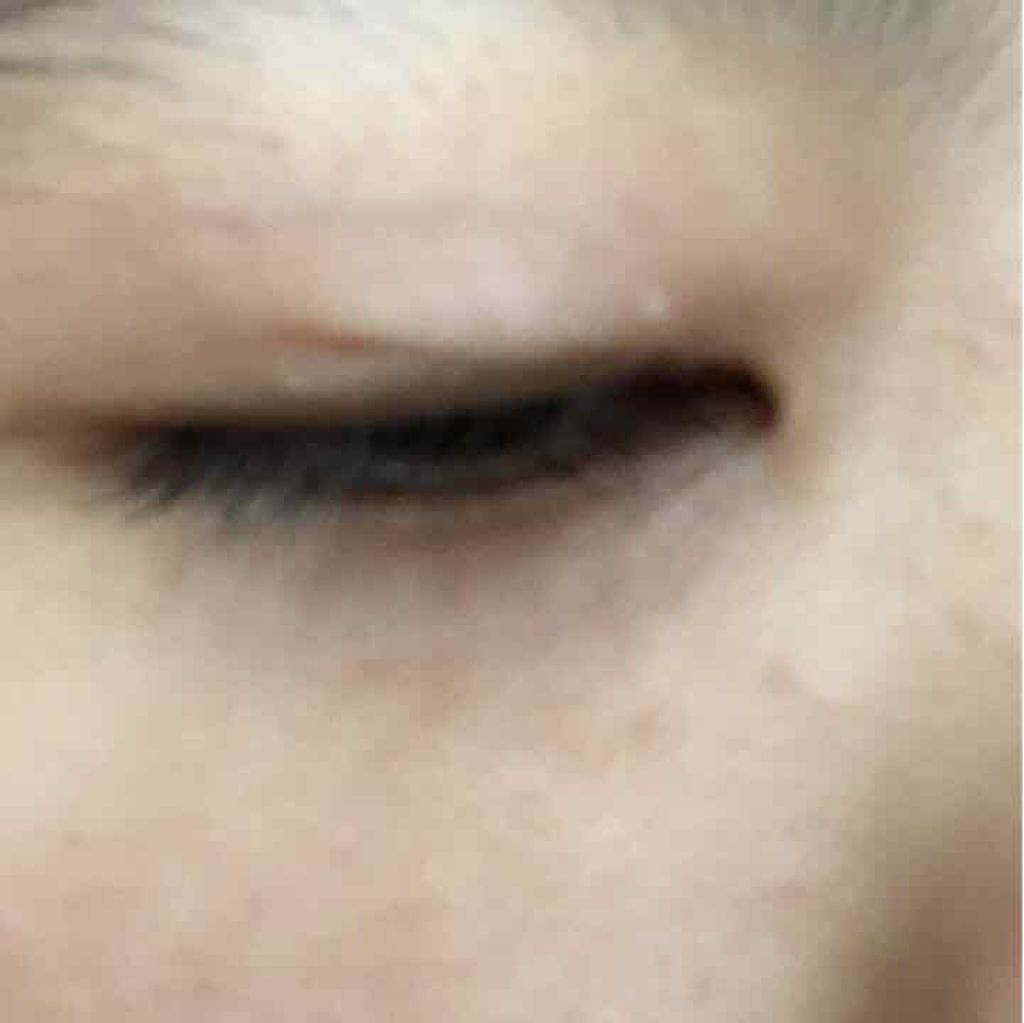 アイトーク/アイトーク/二重まぶた用アイテムを使ったクチコミ（2枚目）