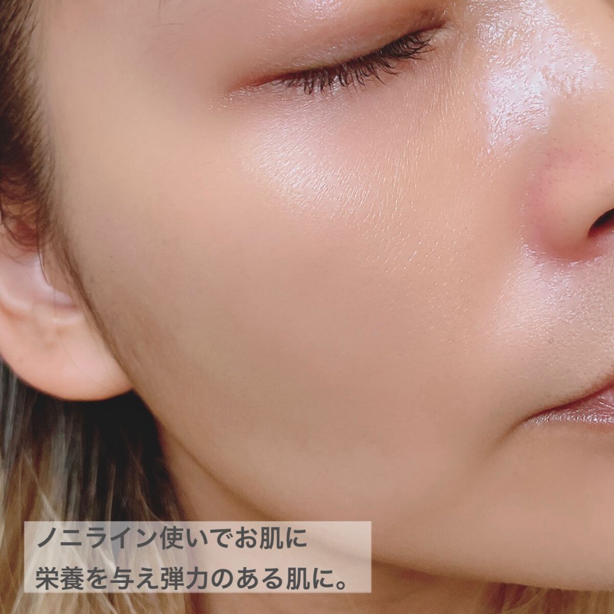 ノニスターターキット/celimax/トライアルキットを使ったクチコミ(6枚目)