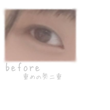 アイビューティー フィクサー WP/アストレア ヴィルゴ/二重まぶた用アイテムを使ったクチコミ(2枚目)