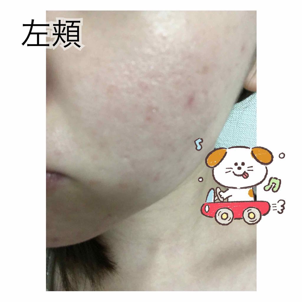 ã¿ããðð on LIPS ãçæ§ã®ãæèŠããèããããã§ããå¯èœã§ããã°ãååé¡ããŸããç§..ãïŒ3æç®ïŒ