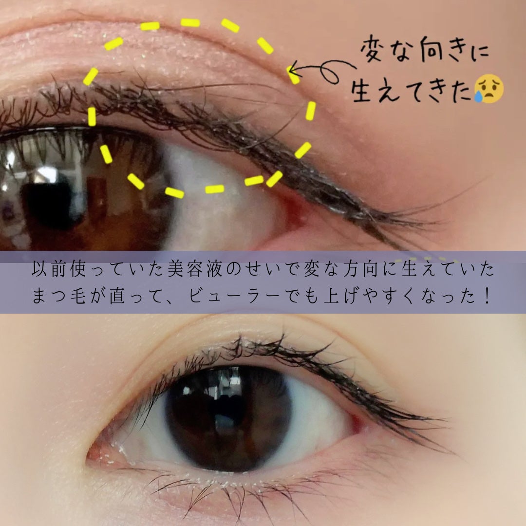 リバイタラッシュ アドバンス センシティヴ/リバイタラッシュ/まつげ美容液を使ったクチコミ(5枚目)