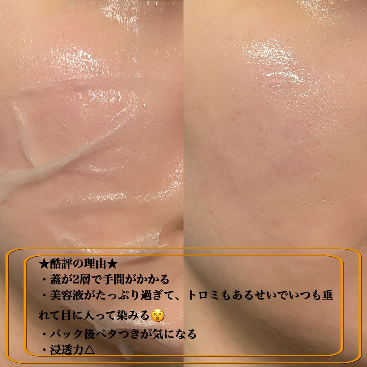 クリアエッセンスマスク/ピュレア/シートマスク・パックを使ったクチコミ(3枚目)