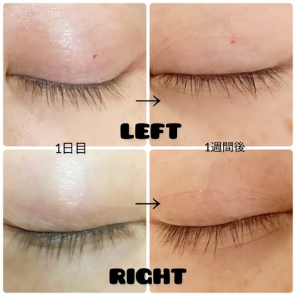 ラッシュジェリードロップ EX/MAJOLICA MAJORCA/まつげ美容液を使ったクチコミ(4枚目)