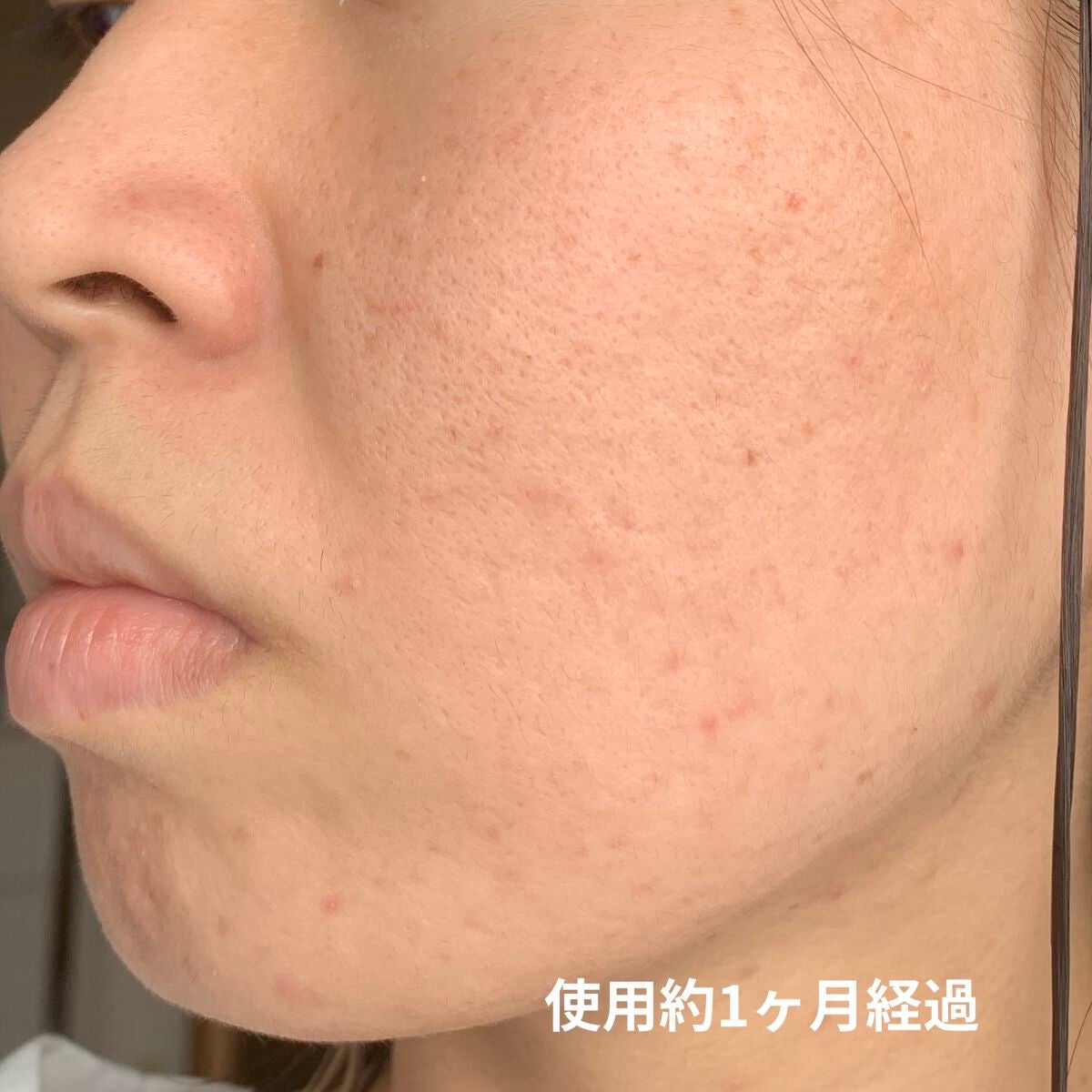 モイスチャーバランスローション/PHOEBE BEAUTY UP/化粧水を使ったクチコミ(3枚目)