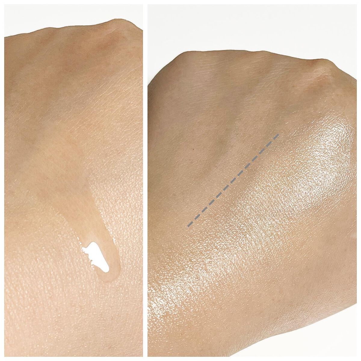 バイオイル/バイオイル/フェイスオイルを使ったクチコミ(2枚目)