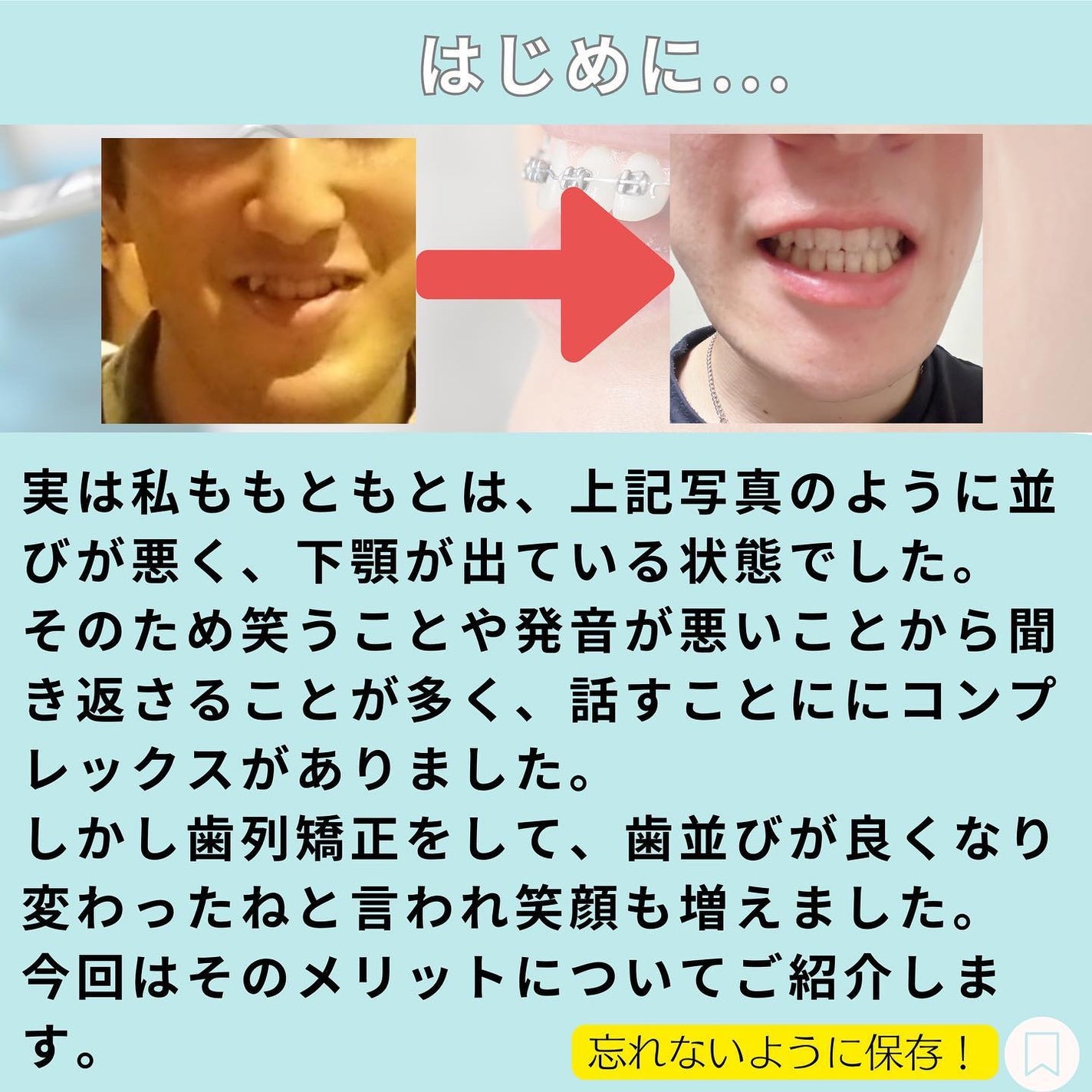じゅん on LIPS 「こんにちは!じゅんです!今回歯列矯正のメリットについて紹介しま..」(2枚目)
