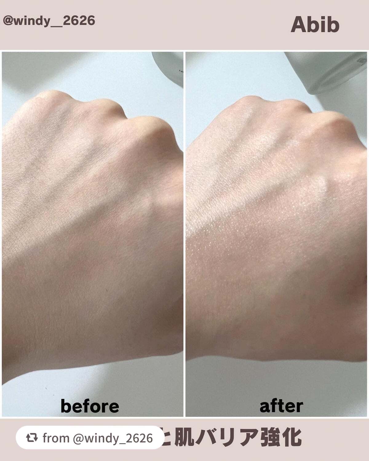 復活草ビフィダセラムファーミングドロップ/Abib /美容液を使ったクチコミ(4枚目)