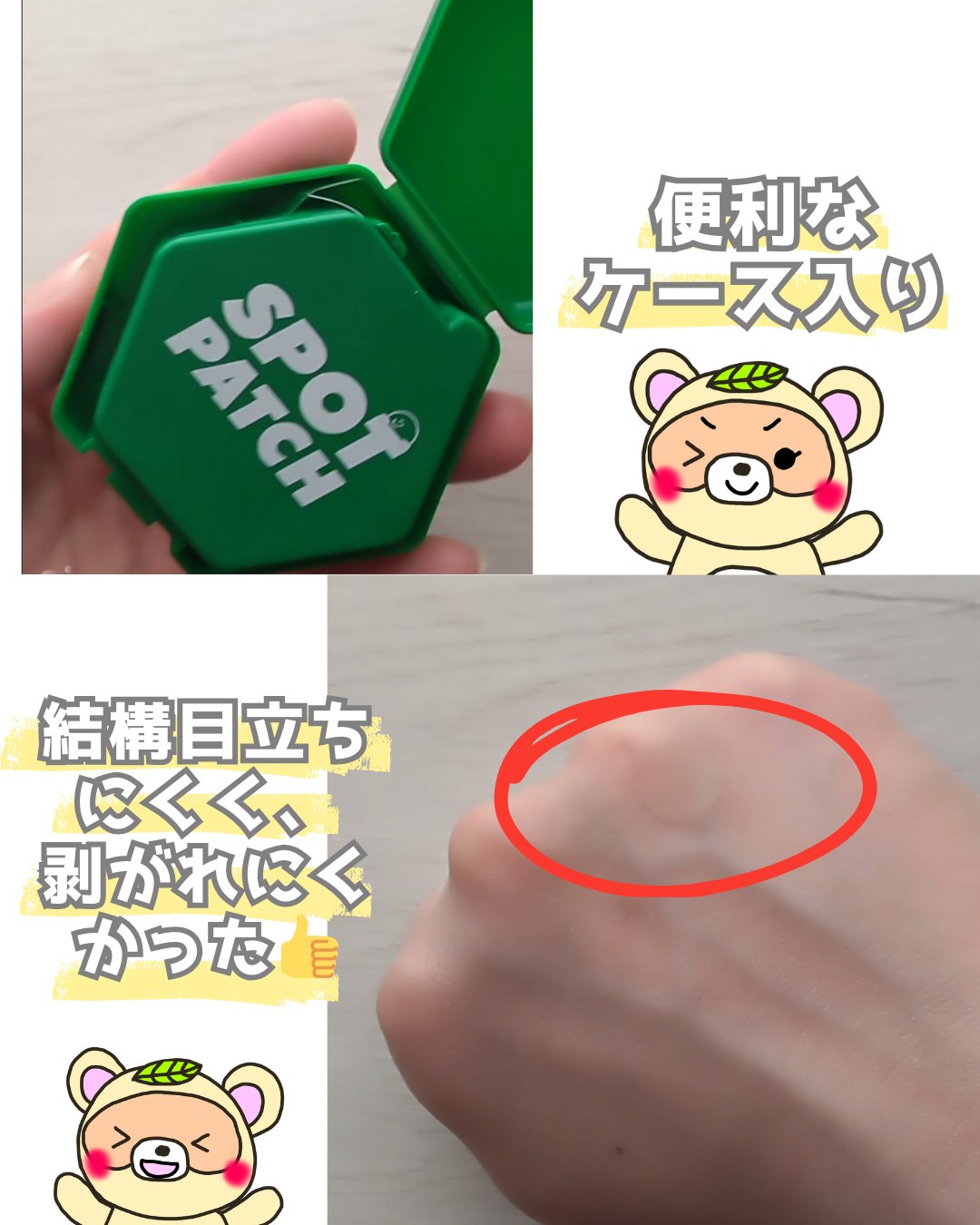 SPOT PATCH ロールタイプ/Shupong/にきびパッチを使ったクチコミ（3枚目）