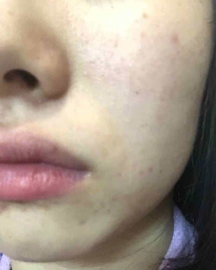 EclatCharme(エクラシャルム)/FABIUS/オールインワン化粧品を使ったクチコミ(3枚目)