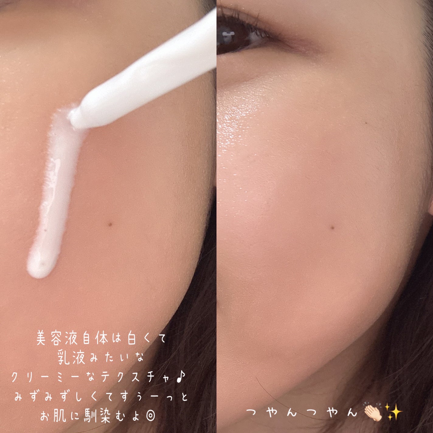 トラコア ラジエンス アンプル /イナベロ/美容液を使ったクチコミ(3枚目)