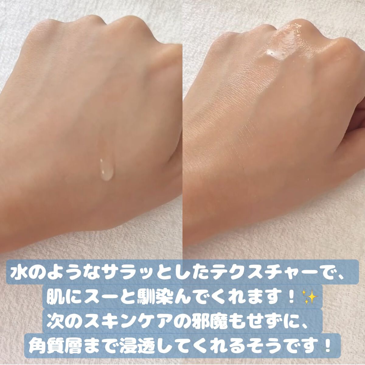 タカミスキンピール/タカミ/ブースター・導入液を使ったクチコミ（2枚目）