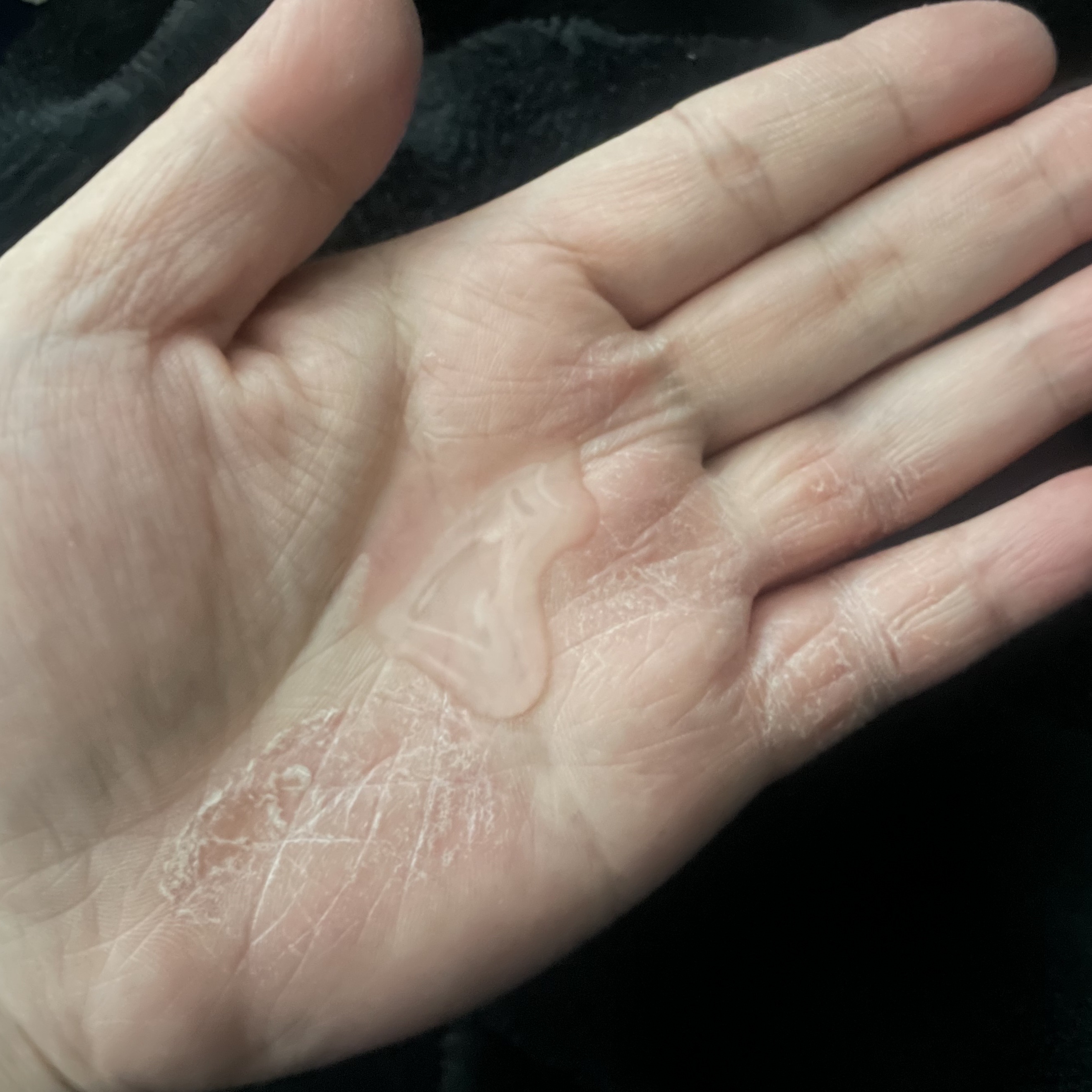 白潤プレミアム 薬用浸透美白化粧水(しっとりタイプ)/肌ラボ/化粧水を使ったクチコミ（3枚目）