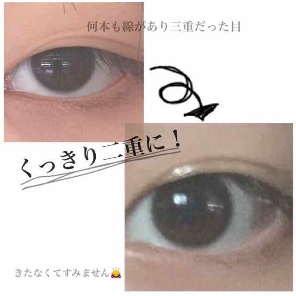 ハイブリッドフィルム/アイトーク/二重まぶた用アイテムを使ったクチコミ（2枚目）