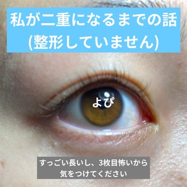 アイテープ（絆創膏タイプ、レギュラー、７０枚）/DAISO/二重まぶた用アイテムを使ったクチコミ（1枚目）