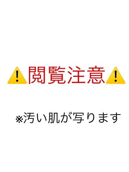明色美顔水 薬用化粧水/美顔/化粧水を使ったクチコミ(1枚目)
