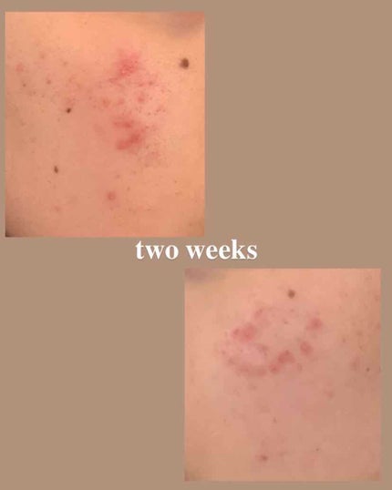 ã䜿ã£ãã¯ãã³ãïŒ2æç®ïŒ