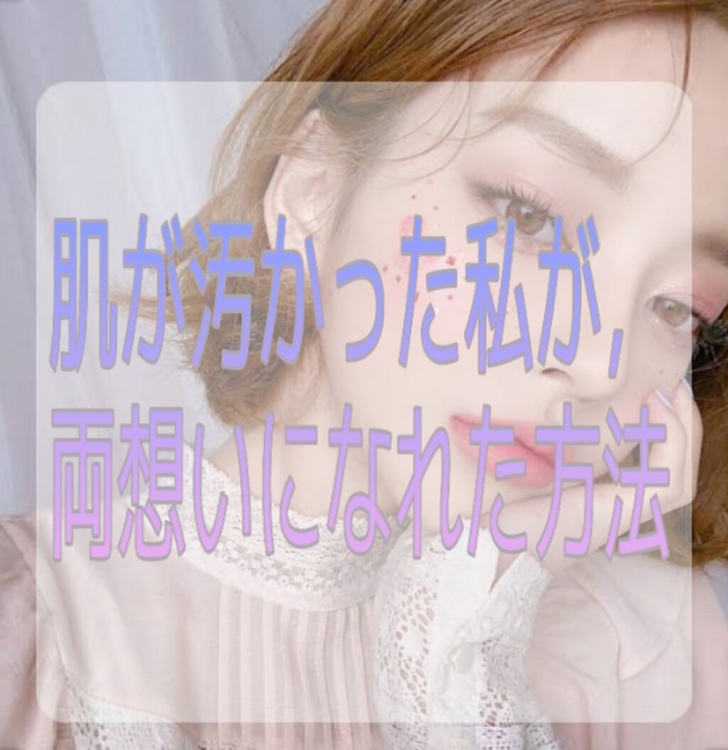 薬用ふわふわな泡洗顔/メンソレータム アクネス/泡洗顔を使ったクチコミ（1枚目）