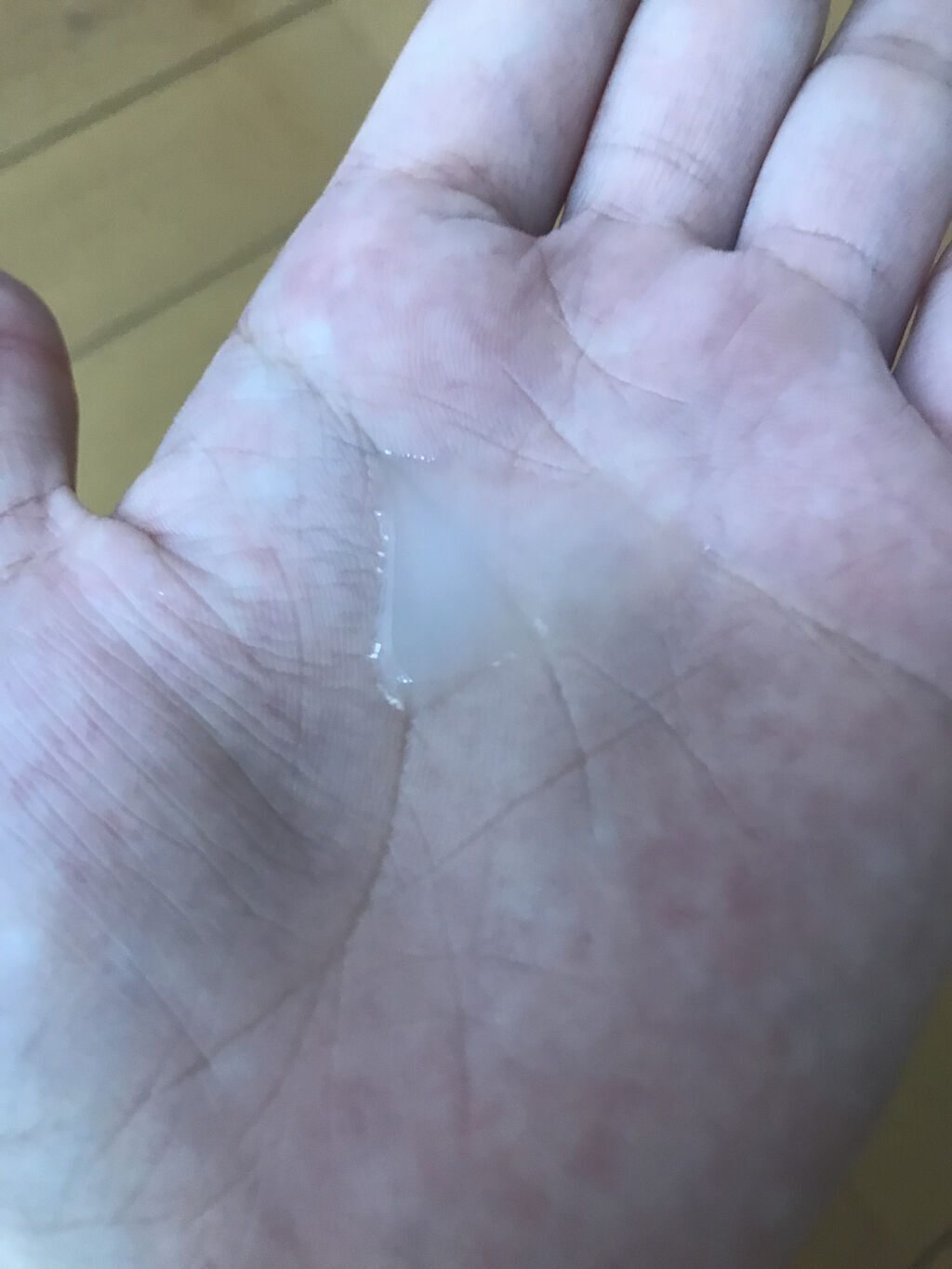 ペアアクネクリームW(医薬品)/ペア/その他を使ったクチコミ（3枚目）