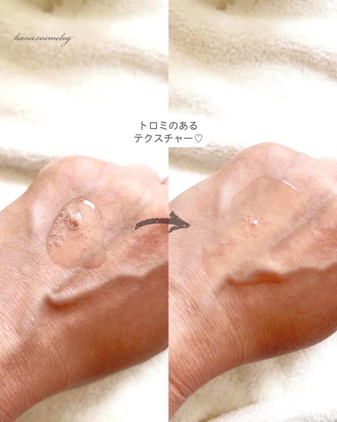 バイタルアクト ローション MB/d プログラム/化粧水を使ったクチコミ（2枚目）