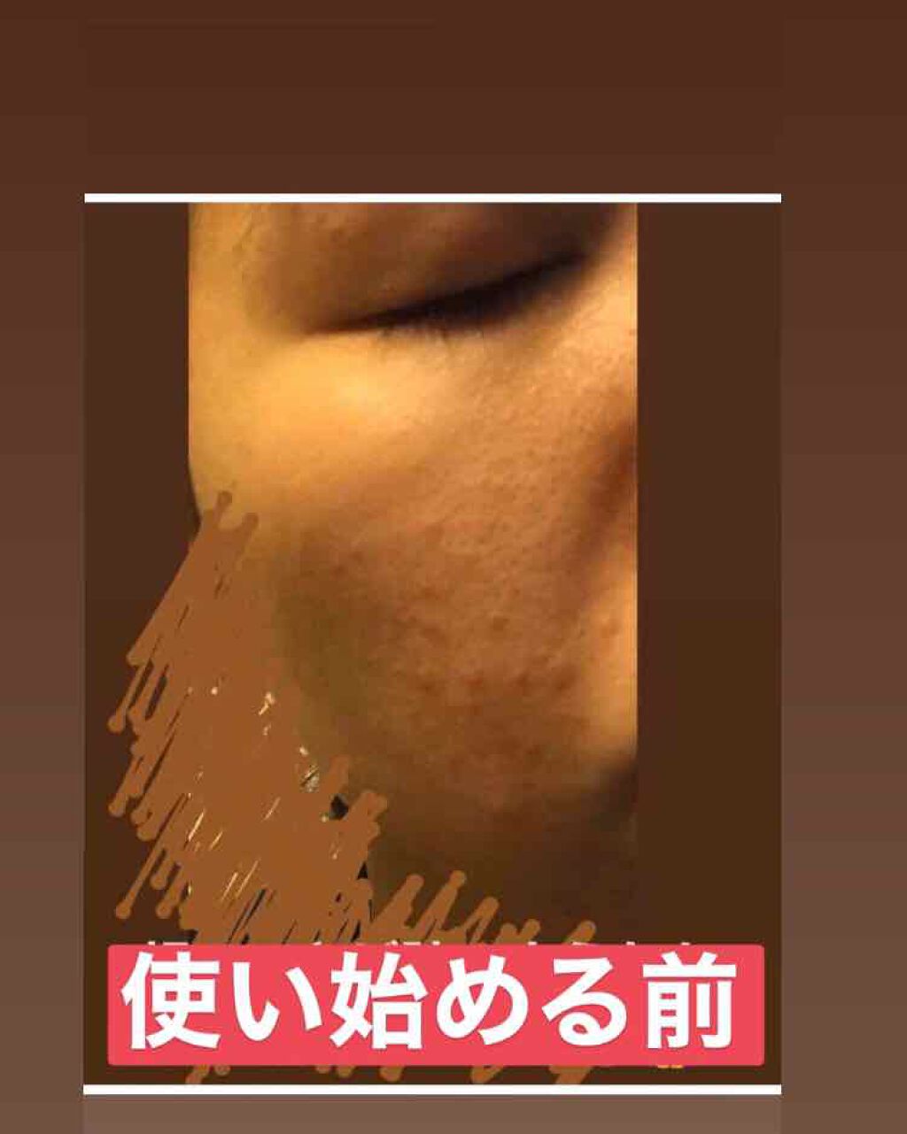 薬用 しみ 集中対策 美容液/メラノCC/美容液を使ったクチコミ(2枚目)