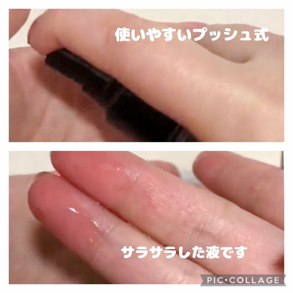 モウダス 薬用 発毛促進剤/北の快適工房/頭皮ローションを使ったクチコミ（3枚目）