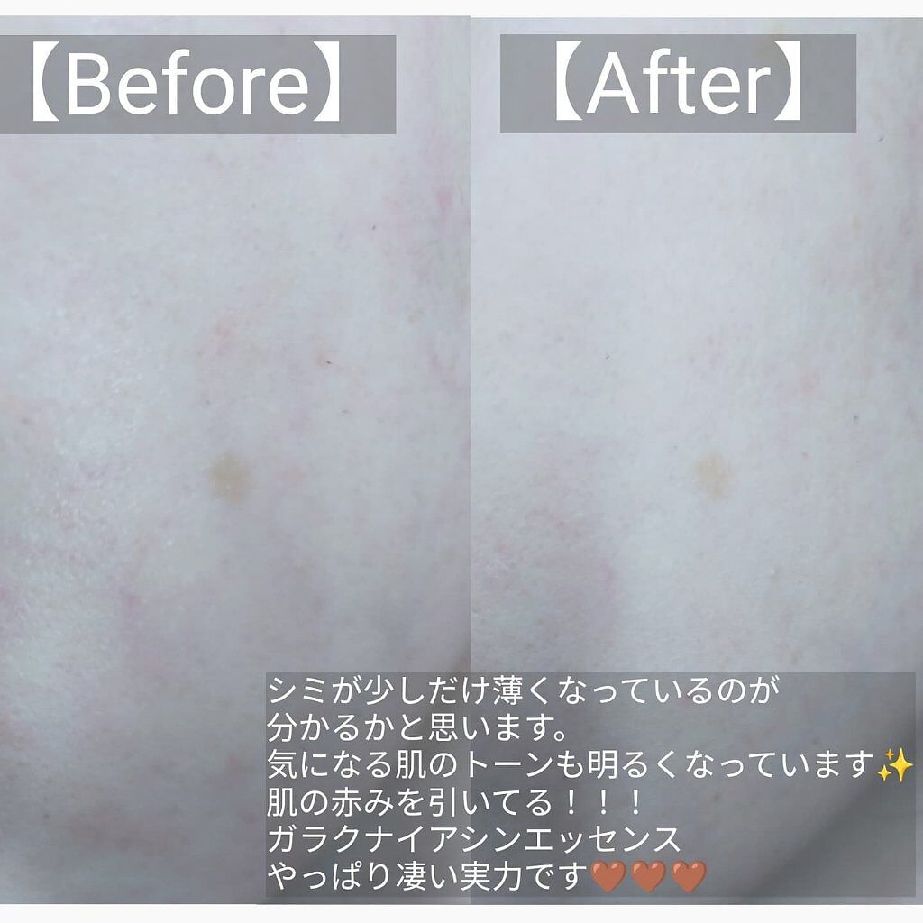 ガラクナイアシン2.0エッセンス/manyo/美容液を使ったクチコミ（2枚目）