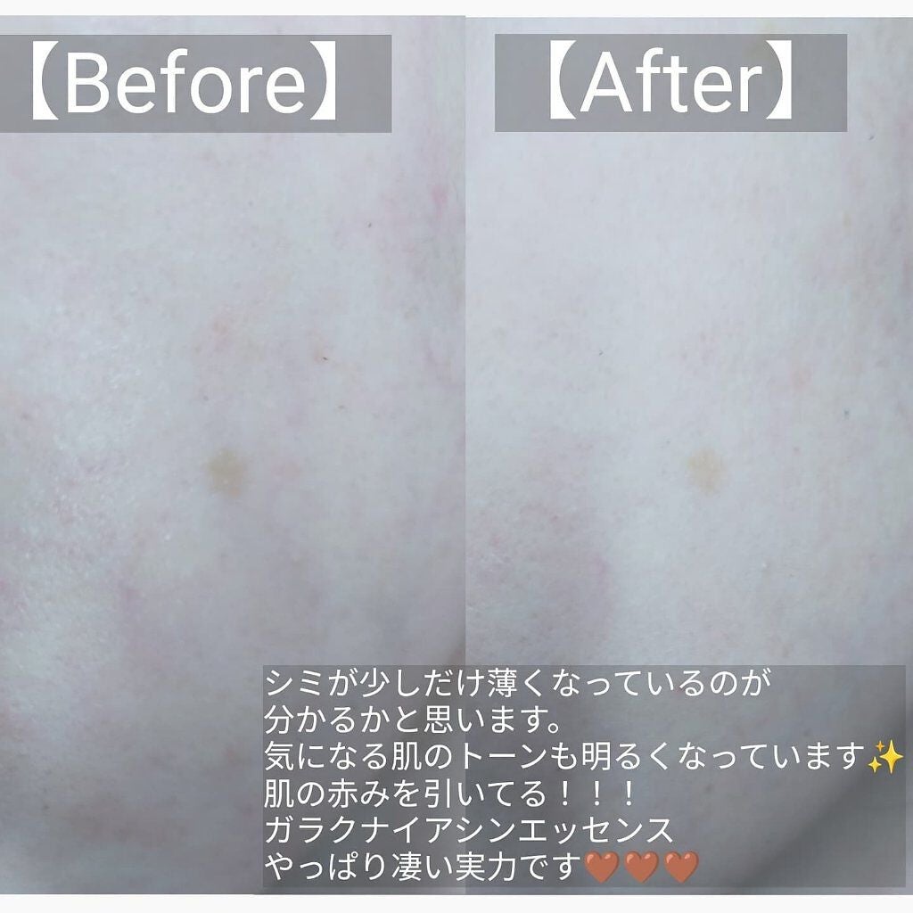 ガラクナイアシン2.0エッセンス/manyo/美容液を使ったクチコミ(2枚目)