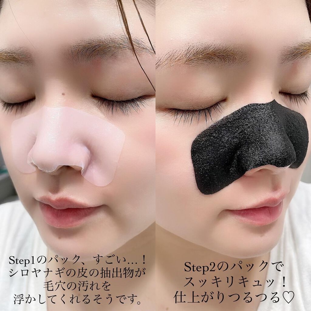 ブラックヘッドクリア2ステップノーズパッチ/DPU/シートマスク・パックを使ったクチコミ(4枚目)