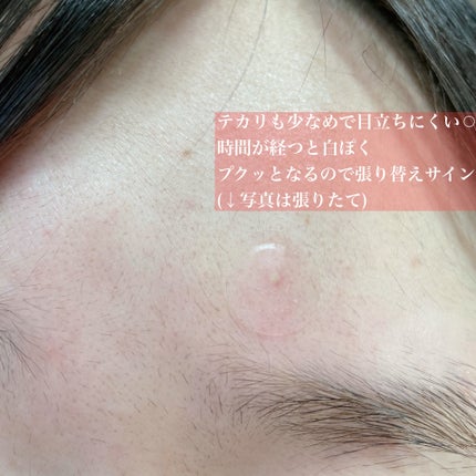キャッチミーパッチ/CATCH ME PATCH/にきびパッチを使ったクチコミ(5枚目)