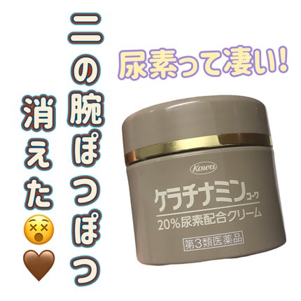 コーワ20%尿素配合クリーム(医薬品)/ケラチナミン/その他を使ったクチコミ(1枚目)