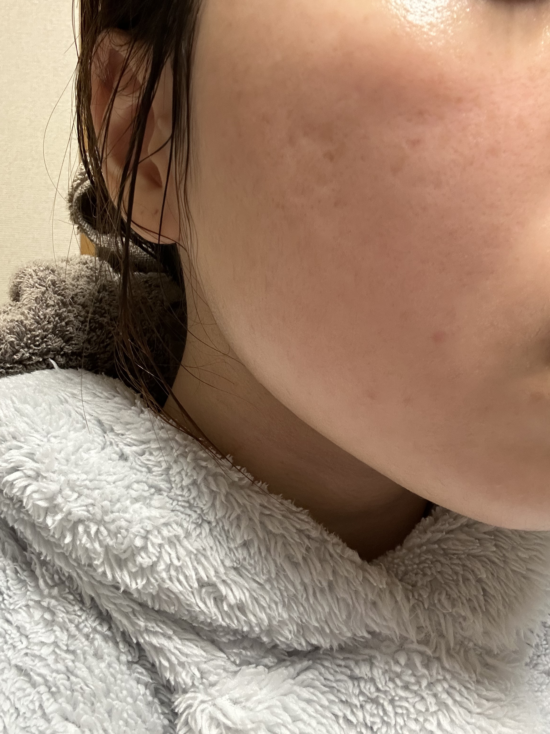 THE N.M.F APマスクJEX/MEDIHEAL/シートマスク・パックを使ったクチコミ（2枚目）