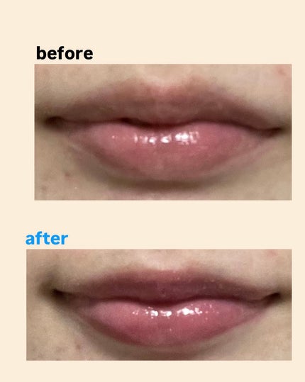 エッセンス リッププランパー/Visée/リッププランパーを使ったクチコミ(3枚目)