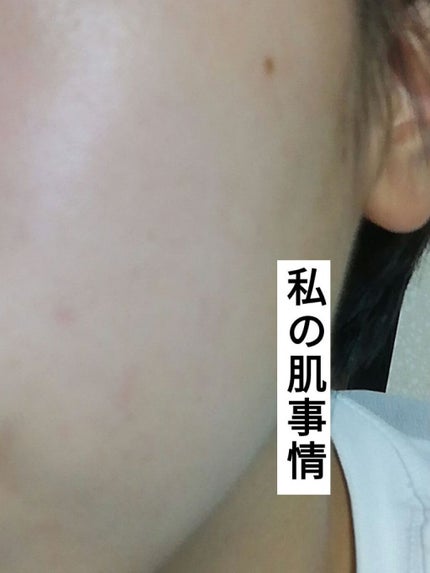 白潤 薬用美白乳液/肌ラボ/乳液を使ったクチコミ(1枚目)