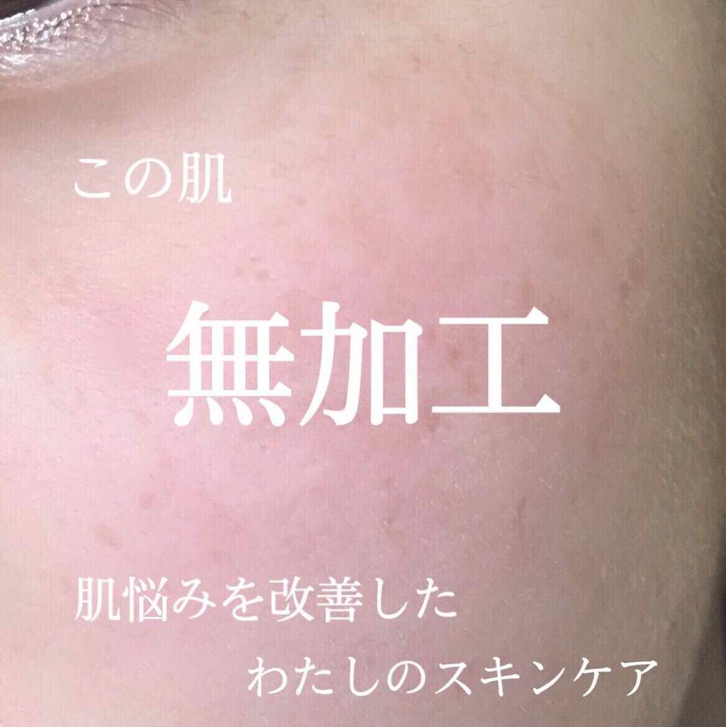 ボタニカル高保湿ジェル/NICE ＆ QUICK/美容液を使ったクチコミ（1枚目）