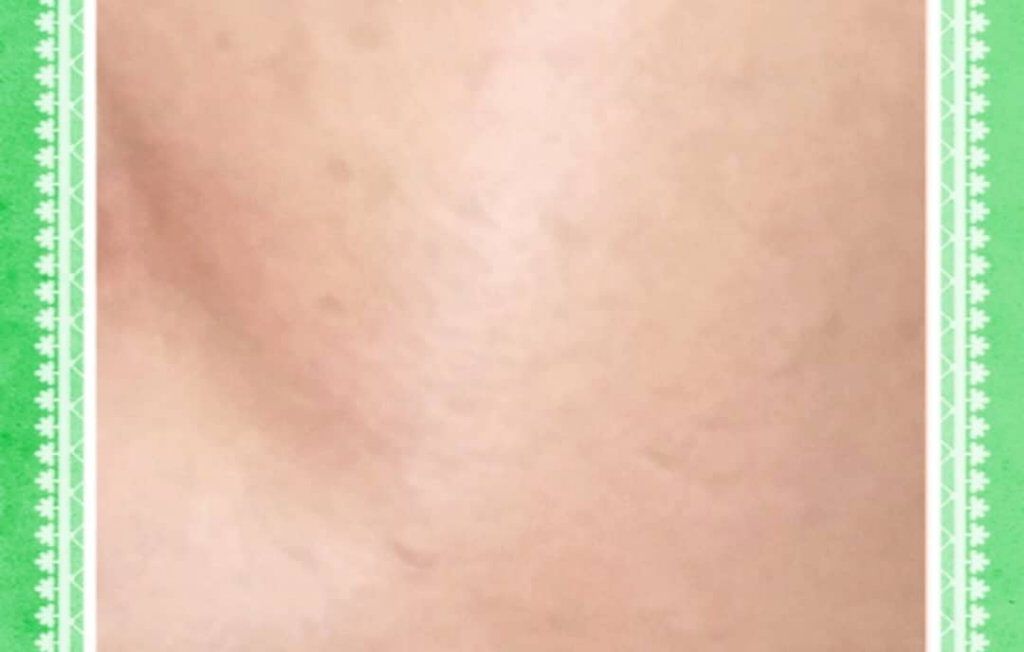 フローレス フィット/COVERMARK/クリーム・エマルジョンファンデーションを使ったクチコミ(7枚目)