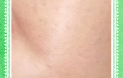 フローレス フィット/COVERMARK/クリーム・エマルジョンファンデーションを使ったクチコミ(7枚目)