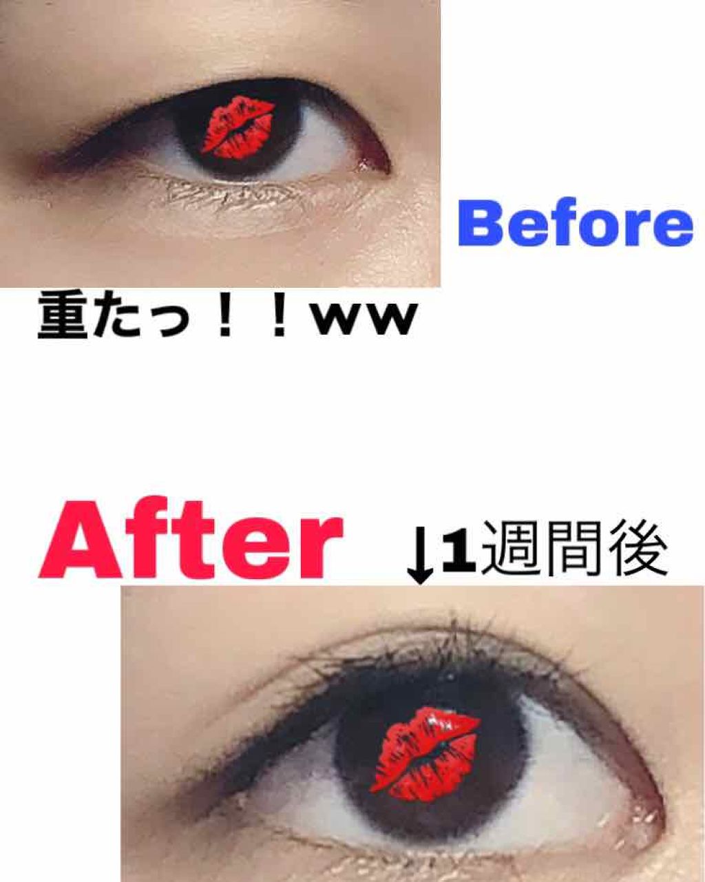 アイテープ 埋没式両面テープ/DAISO/二重まぶた用アイテムを使ったクチコミ（2枚目）