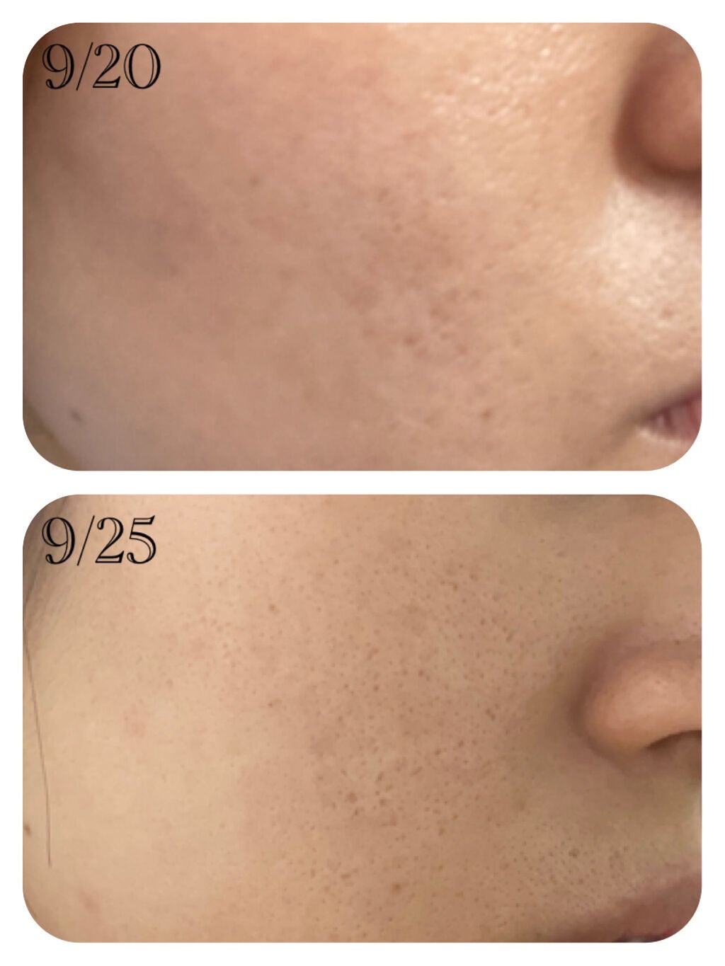 リンクルナイトクリーム/なめらか本舗/フェイスクリームを使ったクチコミ(3枚目)