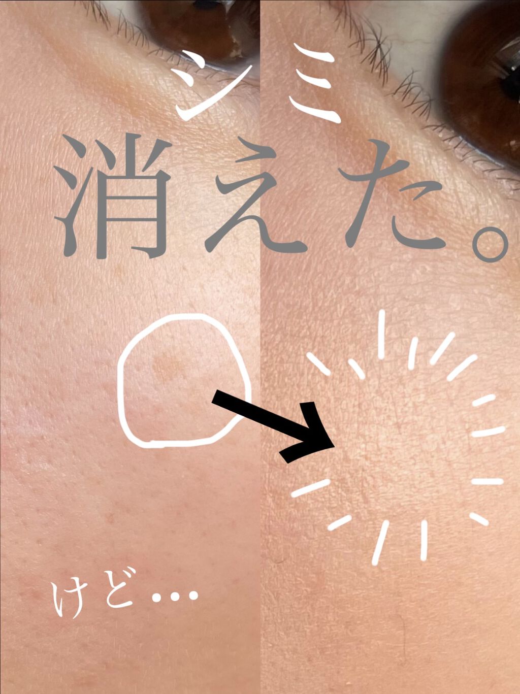 CC コンシーラー/Visée/リキッドコンシーラーを使ったクチコミ（1枚目）