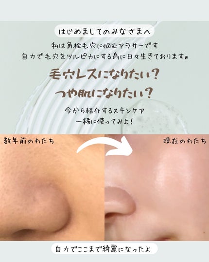 シカレチA エッセンス0.1/VT/美容液を使ったクチコミ(2枚目)