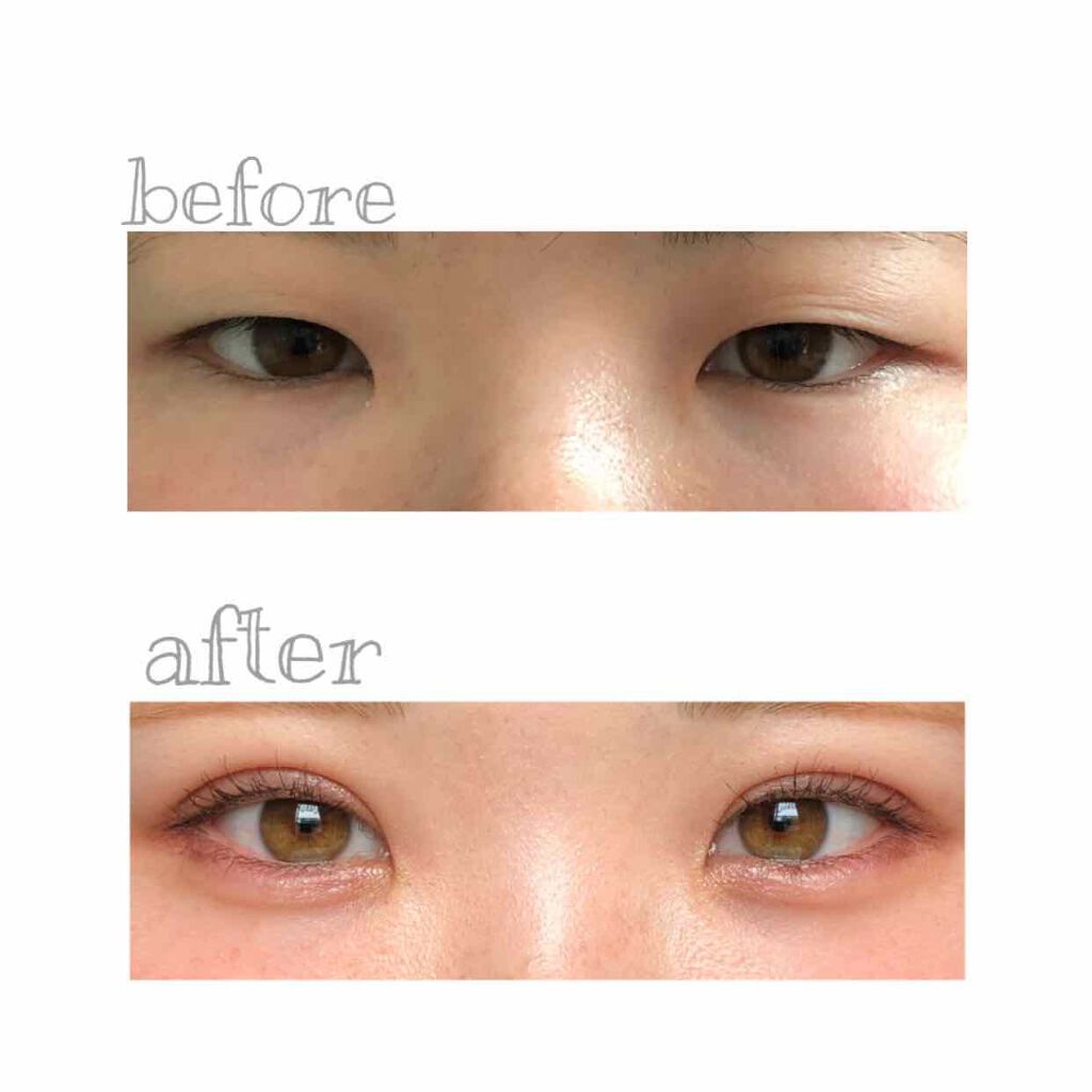 ぱな on LIPS 「重い重い一重がコンプレックスだった私…8年間アイプチを頑張って..」(1枚目)