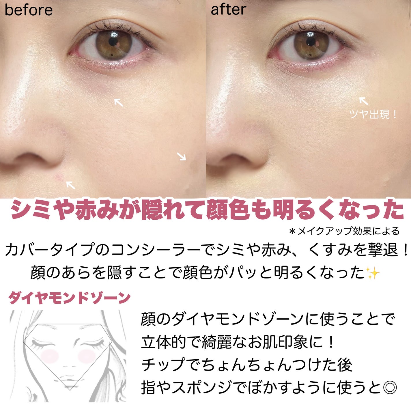ダイヤモンドティップス コンシーラー<カバータイプ>/JILL STUART/リキッドコンシーラーを使ったクチコミ(6枚目)