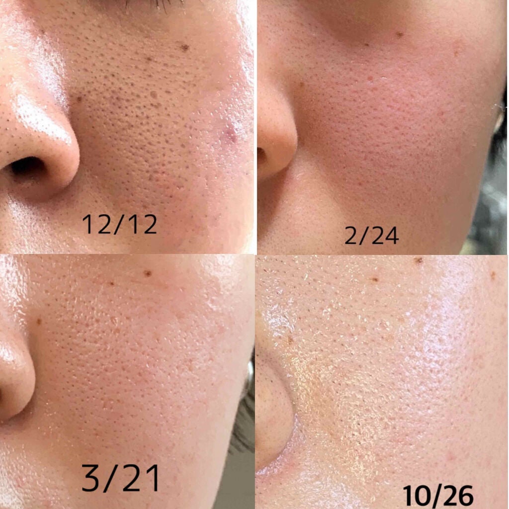 ハトムギ化粧水(ナチュリエ スキンコンディショナー R )/ナチュリエ/化粧水を使ったクチコミ(2枚目)